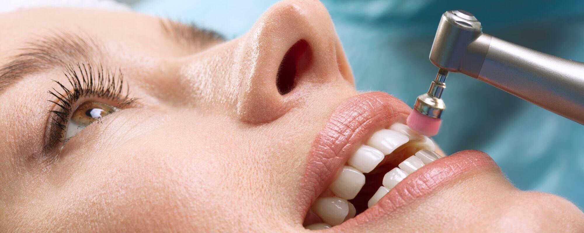 zahnfleischbehandlung